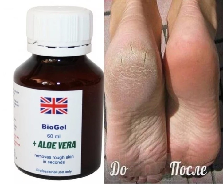 Биогель для педикюра и маникюра BioGel + Aloe Vera (190)